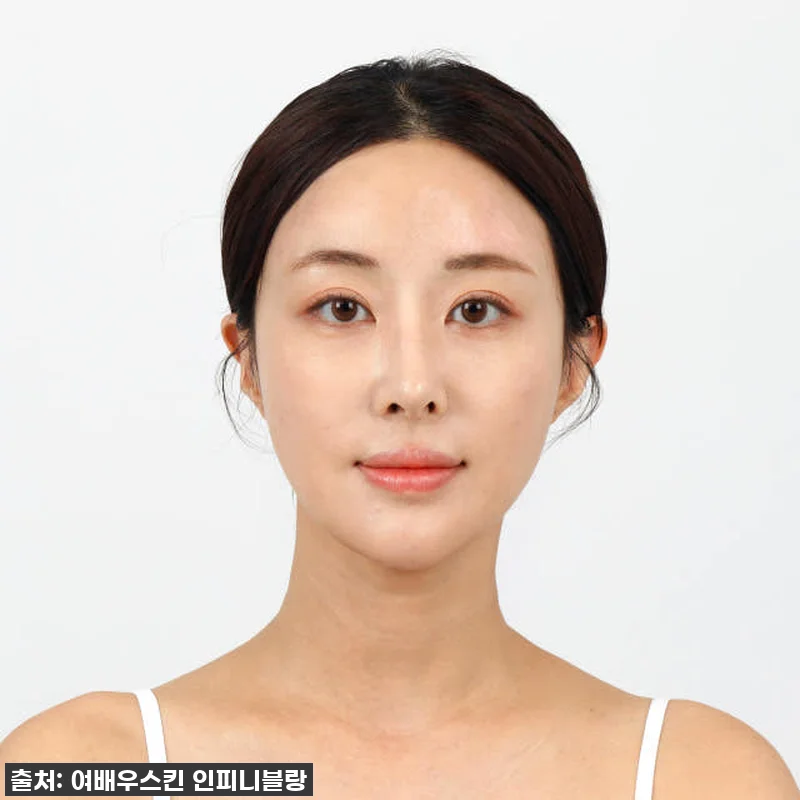 이거 없으면 안 돼! 💛3+1 루미너 관련 이미지 4