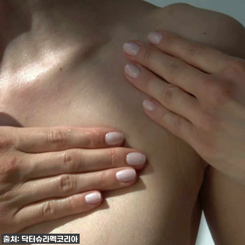 나이테처럼 깊어진 목주름? 닥터슈라멕 관련 이미지 4