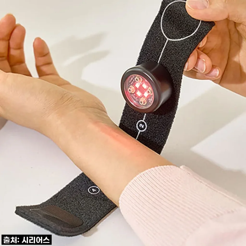 시리어스 레이저 적외선 조사기, 육아와 살림에 지친 나에게 찾아온 작은 구원템! 직접 써보니 대박!